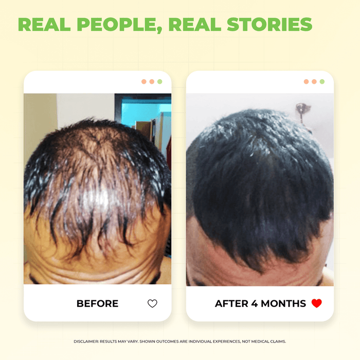 Hard Water Hair Revival Kit for Hairfall & Dryness