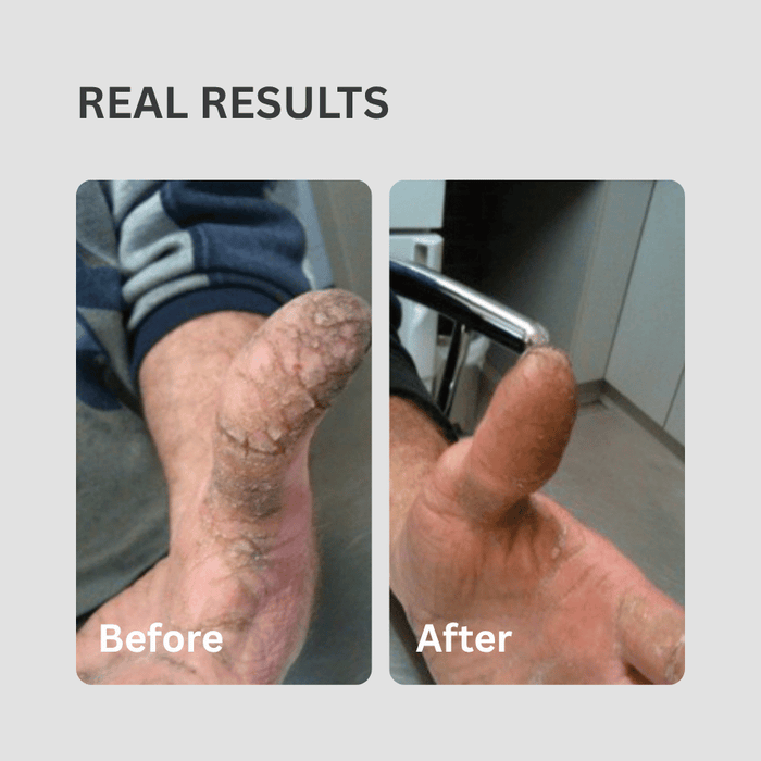 NatraPower HandShield® Liquid Gloves Industrial 150mL